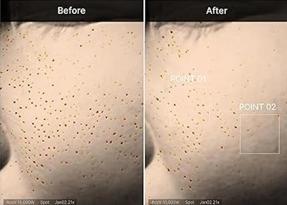 Medicube Zero Pore One Day Serum (30mL)